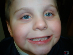 firsttooth.jpg